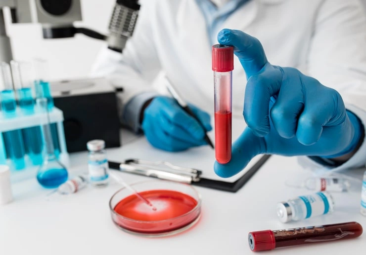 Blood Investigations at Reset Wellness, Gurgaon
